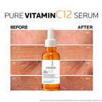 Pure-Vitamin-C12-Serum-Facial-Antiarrugas-Antioxidante2
